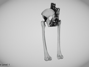 Pelvic Replacement Implant 3D Model