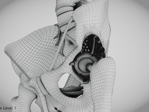 Pelvic Replacement Implant 3D Model