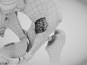 Pelvic Replacement Implant 3D Model