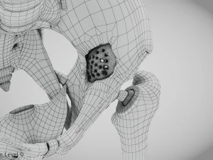 Pelvic Replacement Implant 3D Model