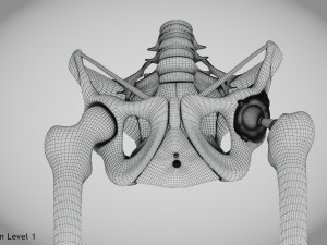 Pelvic Replacement Implant 3D Model