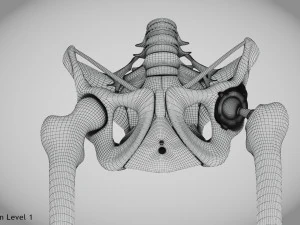Pelvic Replacement Implant 3D Model