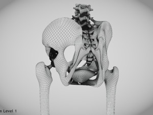 Pelvic Replacement Implant 3D Model