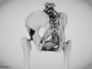 Pelvic Replacement Implant 3D Model