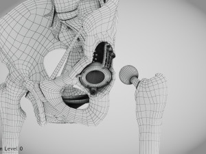 Pelvic Replacement Implant 3D Model