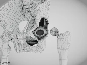 Pelvic Replacement Implant 3D Model