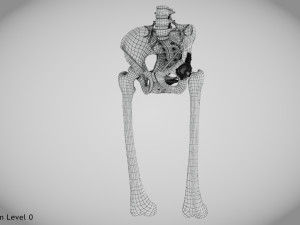 Pelvic Replacement Implant 3D Model