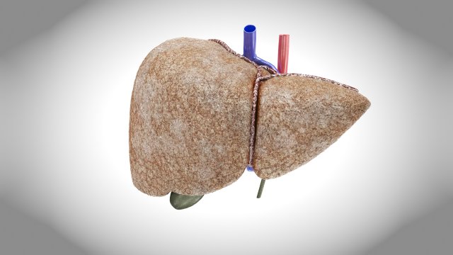 Fibrosis Liver Disease 3D 모델 .c4d .max .obj .3ds .fbx .stl .blend 