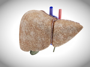 Fibrosis Liver Disease 3D 模型