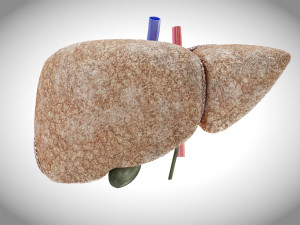 Fibrosis Liver Disease 3D 모델
