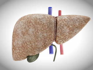 Fibrosis Liver Disease 3D 모델