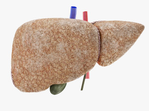 Fibrosis Liver Disease 3D 모델