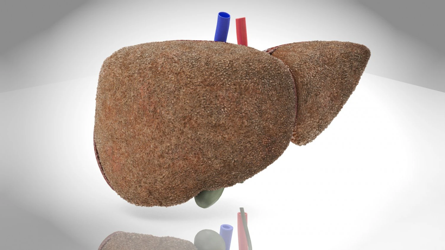 Steatohepatitis Liver Disease 3D Model .c4d .max .obj .3ds .fbx .stl .blend 