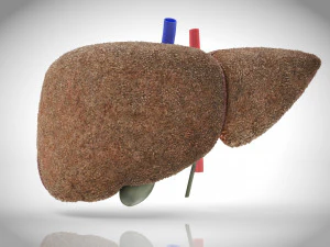 Steatohepatitis Liver Disease 3D Model