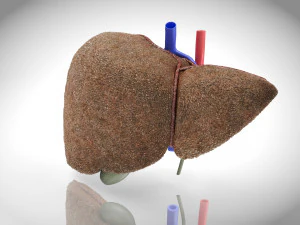Steatohepatitis Liver Disease 3D Model