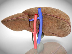 Steatohepatitis Liver Disease 3D Model
