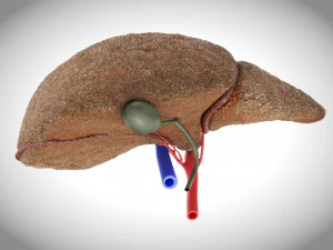 Steatohepatitis Liver Disease 3D Model