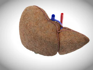 Steatohepatitis Liver Disease 3D Model