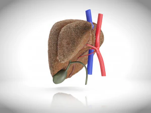 Steatohepatitis Liver Disease 3D Model