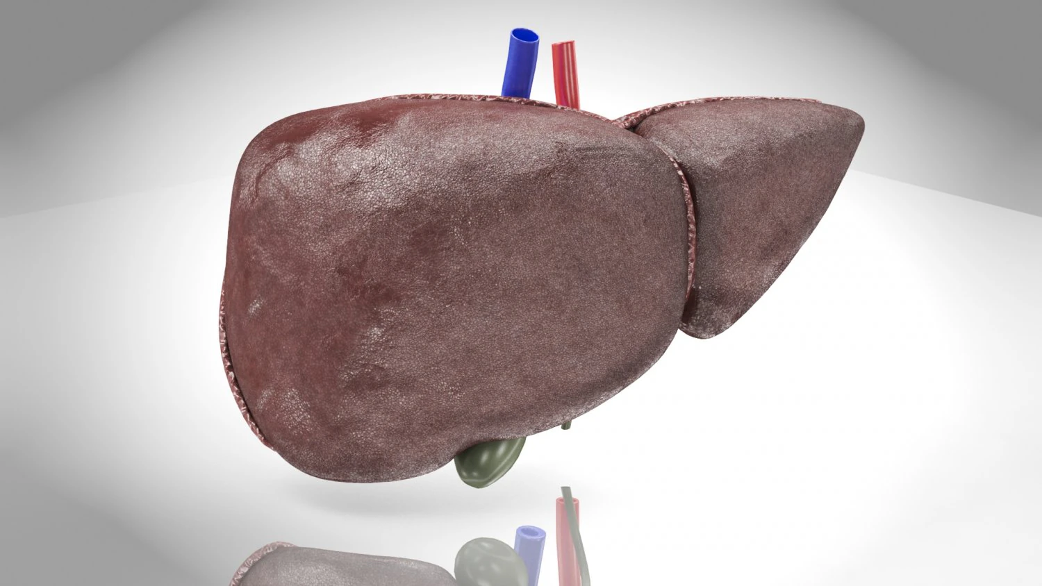 Fatty Liver Steatosis 3D Model .c4d .max .obj .3ds .fbx .stl .blend 