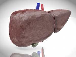 Fatty Liver Steatosis 3D 模型
