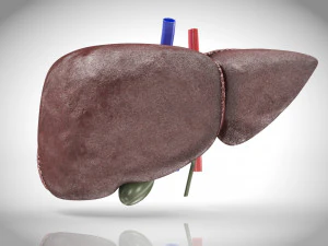 Fatty Liver Steatosis 3D Model