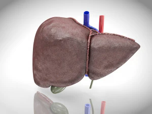 Fatty Liver Steatosis 3D Model