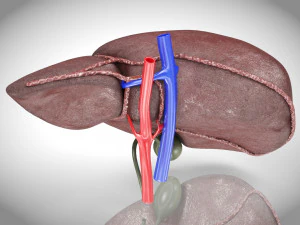 Fatty Liver Steatosis 3D Model