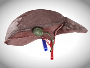 Fatty Liver Steatosis 3D Model