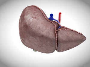 Fatty Liver Steatosis 3D Model