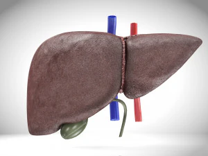 Fatty Liver Steatosis 3D Model