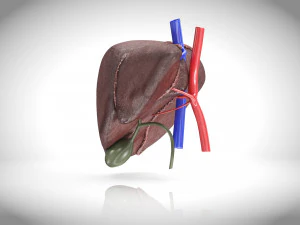 Fatty Liver Steatosis 3D Model