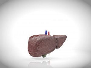 Fatty Liver Steatosis Model 3D