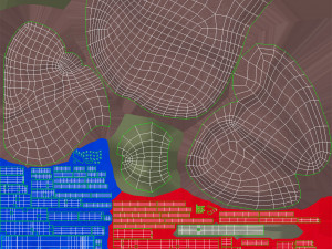 Fatty Liver Steatosis Model 3D