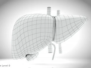 Fatty Liver Steatosis 3D Model