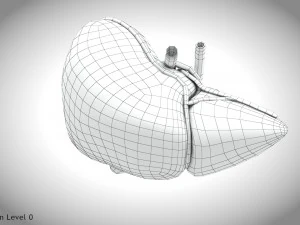 Fatty Liver Steatosis 3D Model