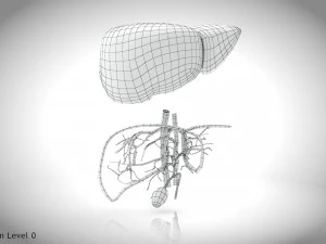Fatty Liver Steatosis 3D Model