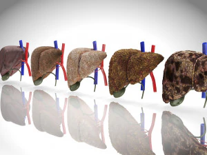 Liver Diseases Collection 3D Model