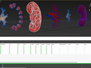 Kidney Anatomy 3D 모델