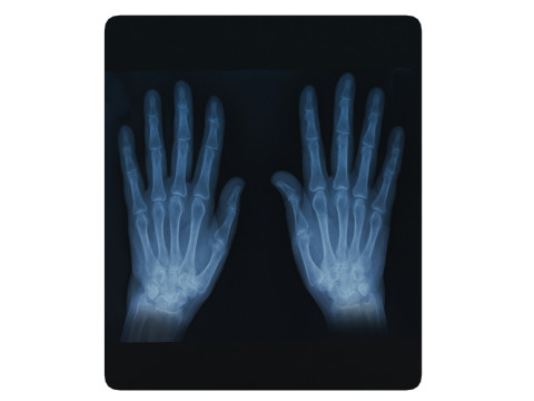 Hand Xray 3Dモデル