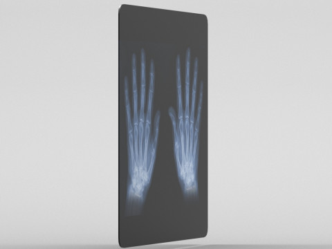 Hand Xray Model 3D
