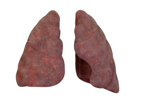 Polmoni umani del fumatore Modello 3D