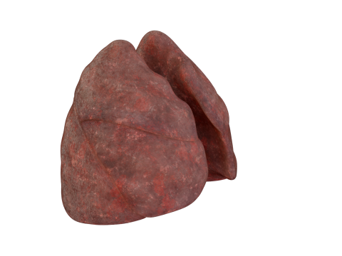 Smoker Human Lungs 3D Model