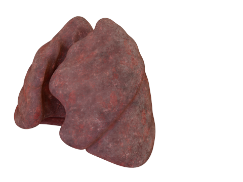 Smoker Human Lungs 3D Model