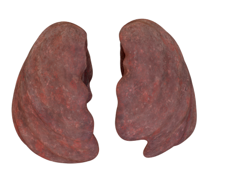 Smoker Human Lungs 3D Model