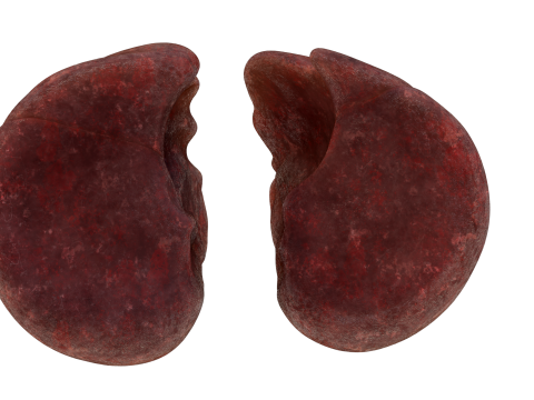 Smoker Human Lungs 3D Model