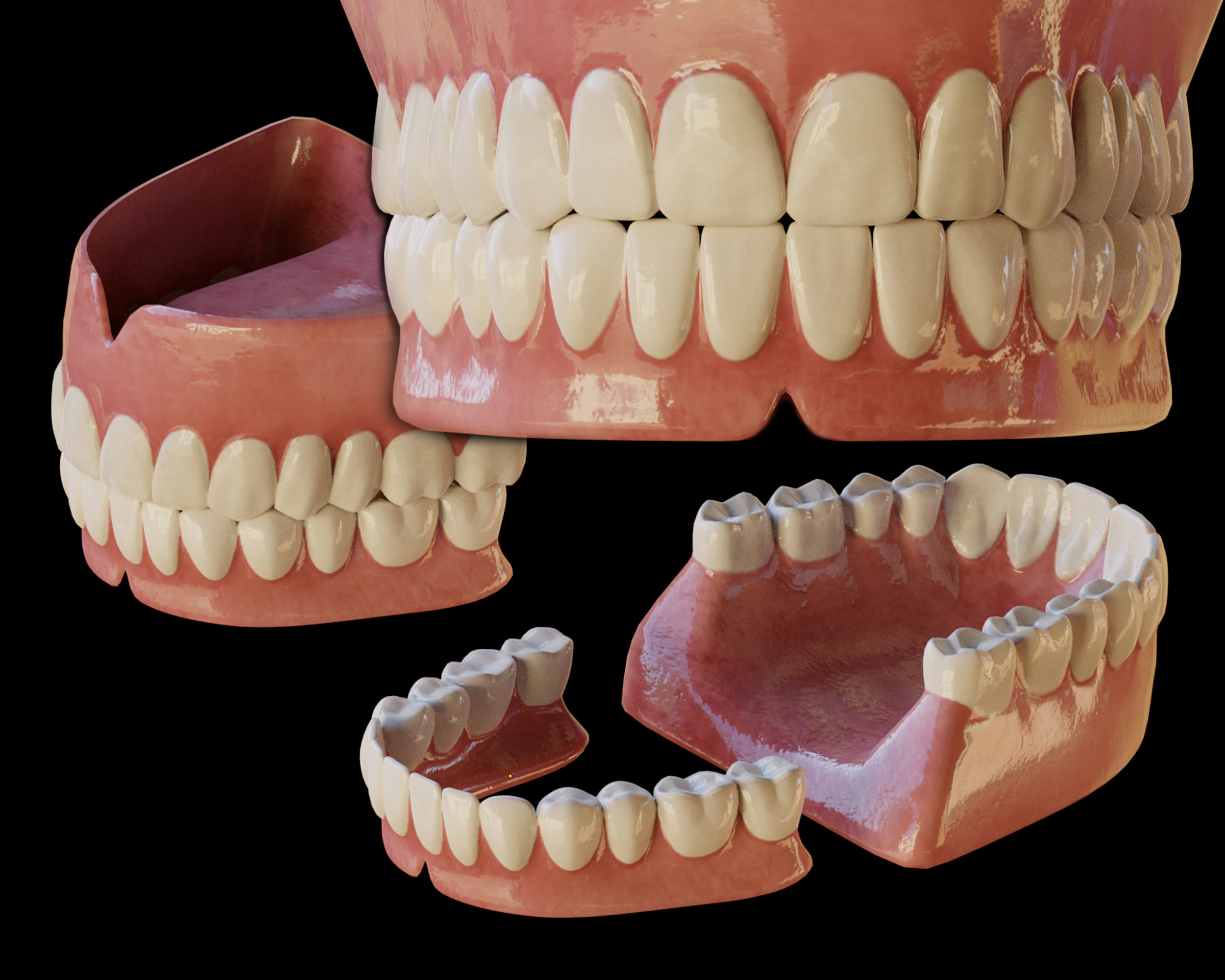 Human Teeth Prosthesis 3D Model .c4d .max .obj .3ds .fbx .stl .blend 