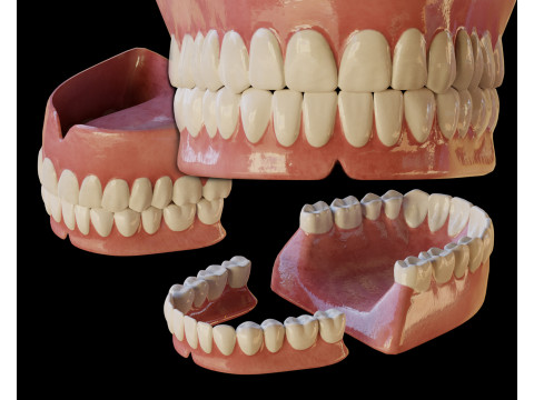 Human Teeth Prosthesis 3D Model