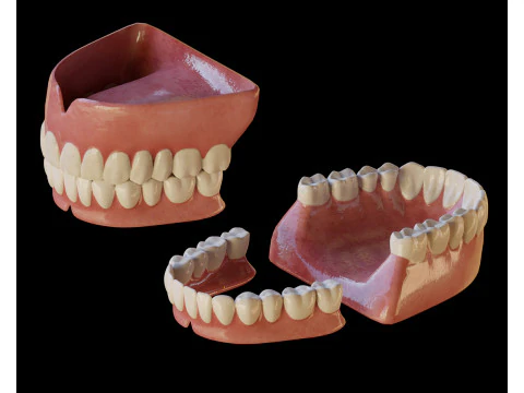 Human Teeth Prosthesis 3D Model