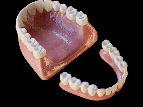 Human Teeth Prosthesis 3D Model
